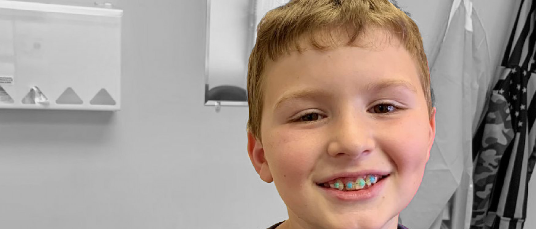 Candy Braces Happy Smiles with Colored Braces